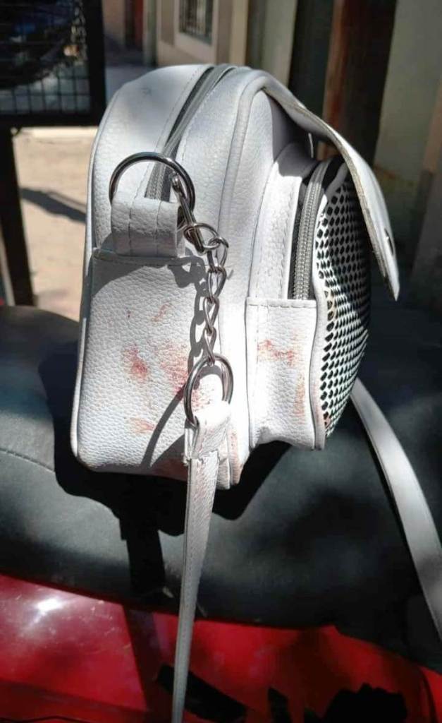 Brutal ataque a la salida de un boliche de Junín. 